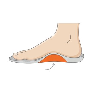 Arch Support